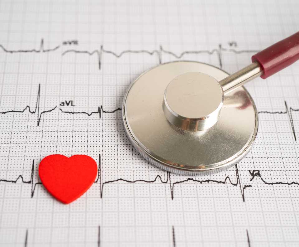 ECG (Electrocardiogram)